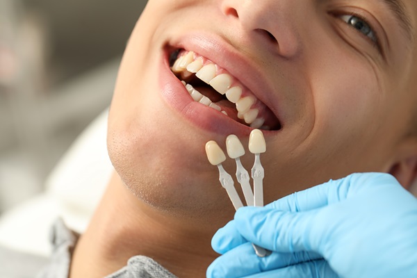 Can Dental Bonding Fix My Smile?